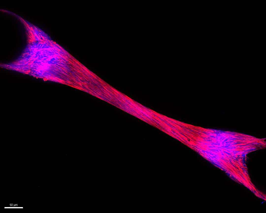 Human 3D bioartificial muscle generated using ProFuse's proprietary muscle cultivation technology. Image credit: ProFuse Technology